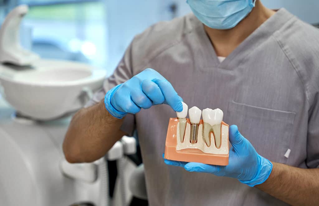 متخصص ایمپلنت دندان